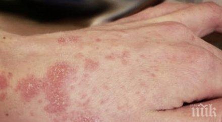 страх пловдив сигнал краста вдигна службите крак