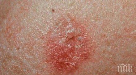 пробив рака хронично заболяване