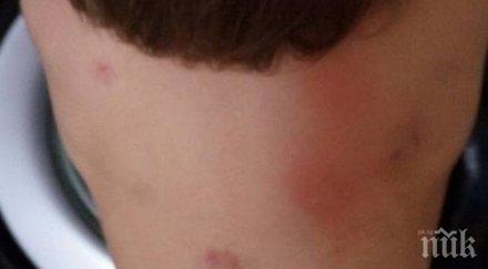 майка шок върнаха дъщеря детската градина нахапана зверски места снимки