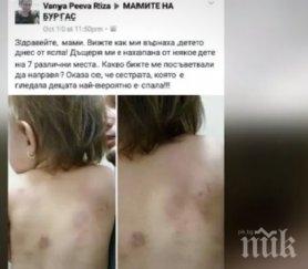 трима души изхвърчаха работа заради нахапано забавачка дете снимка