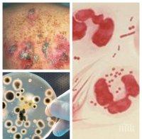 УЖАС! Нов вирус, по-страшен от СПИН, ни атакува по полов път