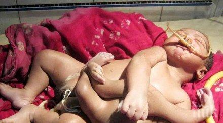 уникално дете четири крака роди мозамбик