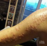 Тотална мизерия! Дървеници и развалена храна в четиризвезден хотел (СНИМКИ)