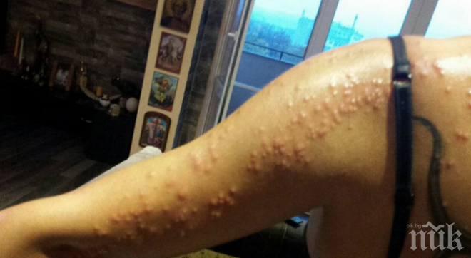 Тотална мизерия! Дървеници и развалена храна в четиризвезден хотел (СНИМКИ)