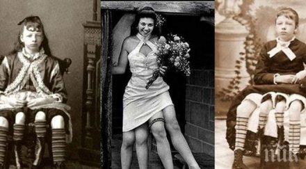 феномен американка четири крака роди пет деца две вагини снимки