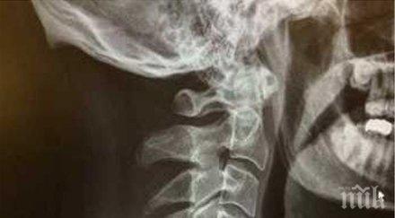 затворник нагълта пирони сложиха диета изкарване