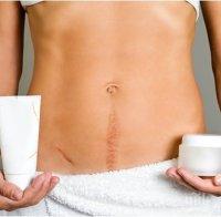 Полезни съвети как да премахнете неприятните белези