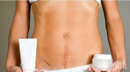 полезни съвети премахнете неприятните белези