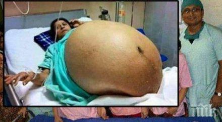 невиждано чудо годишна индийка роди деца минути