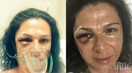 шок мъже пребиха една известните спортистки потресаващи снимки