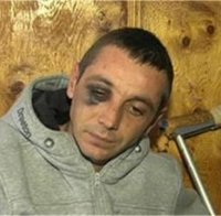 Близки на пребит от полицай: Докараха го в болницата като прасе
