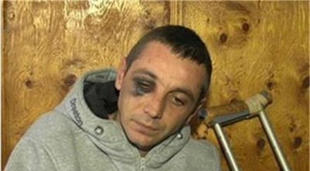 близки пребит полицай докараха болницата прасе