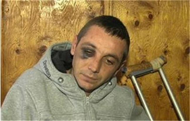 Близки на пребит от полицай: Докараха го в болницата като прасе