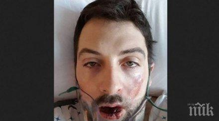 внимавайте понякога електронните цигари причиняват снимка