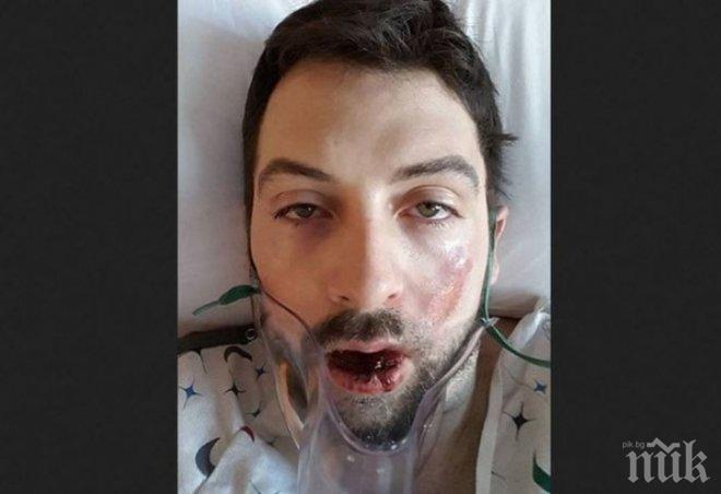 Внимавайте! Понякога електронните цигари причиняват това (СНИМКА 18+) Внимавайте! Понякога електронните цигари причиняват това (СНИМКА 18+)