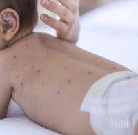 Бум на болни от варицела и скарлатина в Пловдив