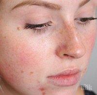 5 знака за недостиг на витамини, които са изписани на лицето