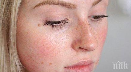 знака недостиг витамини изписани лицето