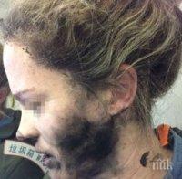 ИНЦИДЕНТ! Слушалките на австралийка експлодираха на главата й по време на полет