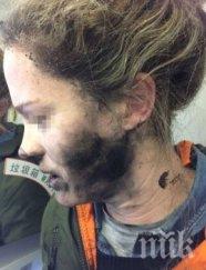 инцидент слушалките австралийка експлодираха главата време полет