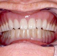 Зъбните протези на възрастните ще се поемат Здравната каса