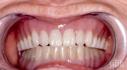 зъбните протези възрастните поемат здравната каса