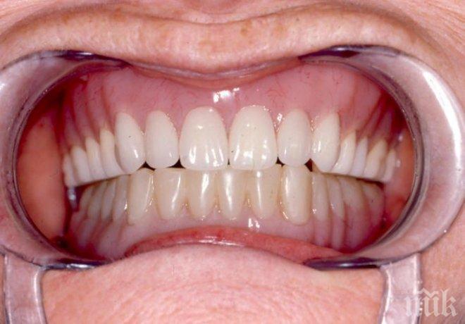 Зъбните протези на възрастните ще се поемат Здравната каса