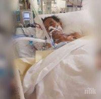 УЖАС! Ампутираха двата крака на мъж, ухапан от паяк