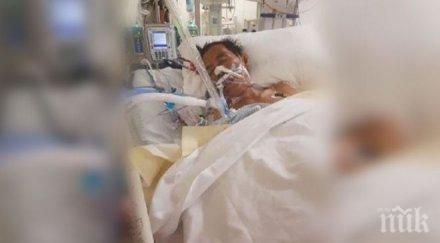 ужас ампутираха двата крака мъж ухапан паяк