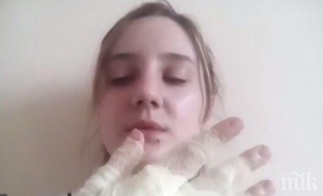 РАЗКАЗИ ОТ АДА! Красивата Ана: Предпазих лицето си от бомбата, но ръцете ми изгоряха