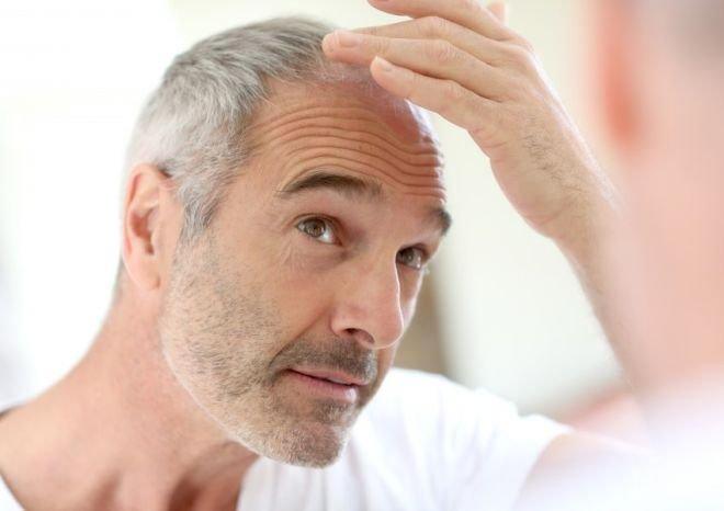 ВНИМАНИЕ! Посивяването на косите показва повишен риск от инфаркт