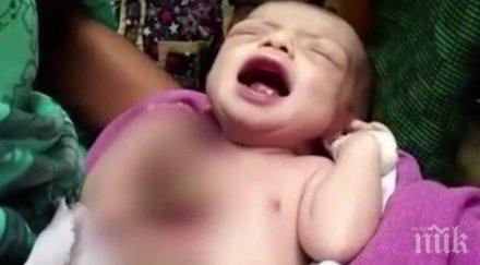 забранено хора слаби нерви роди бебе сърце извън гръдния кош видео