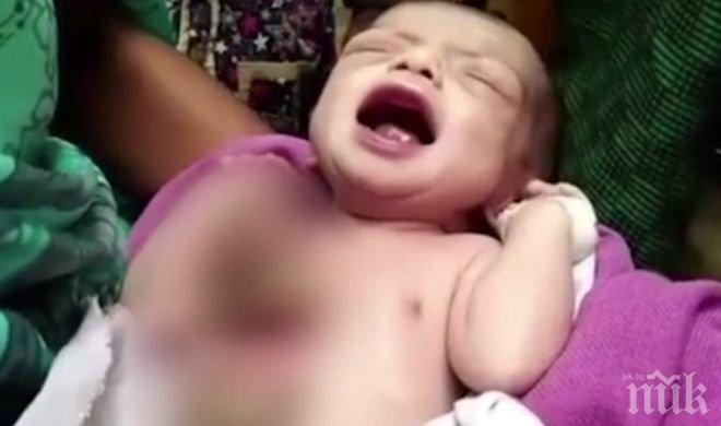 Забранено за хора със слаби нерви! Роди се бебе със сърце извън гръдния кош (ВИДЕО 18+) 