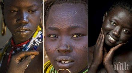 шокиращи кадри годишни момичета обезобразяват красиви кръв инфекции зарази рани спрат снимки