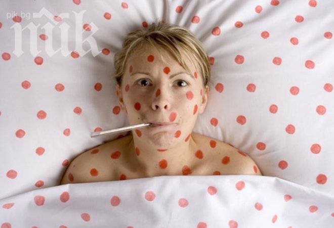 93-ма с варицела за седмица в Перник

