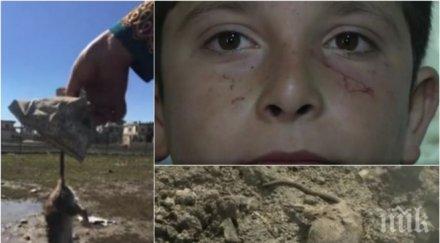шок ужас плъхове ядат лицата деца бежанските лагери потресаващи снимки