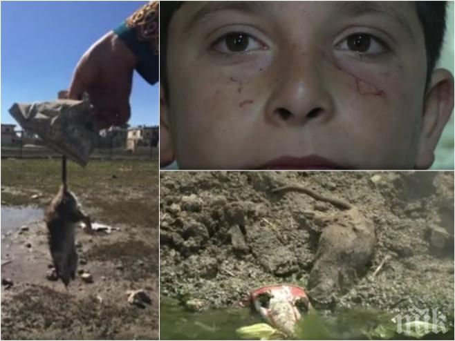 ШОК И УЖАС! Плъхове ядат лицата на деца в бежанските лагери (ПОТРЕСАВАЩИ СНИМКИ 18+)