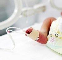 Ужас! Дете с втора глава и трета ръка в областта на корема се е родило в Индия