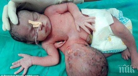 уникално индия роди дете две глави три ръце снимка