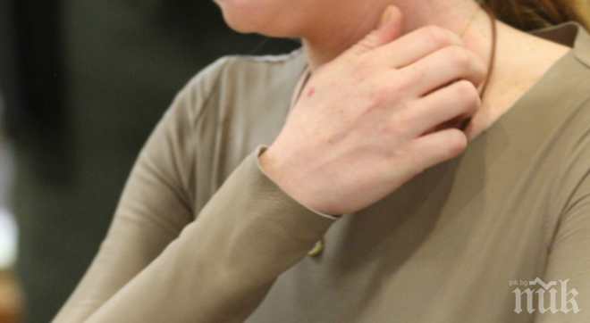 Ето какво причинява екземите