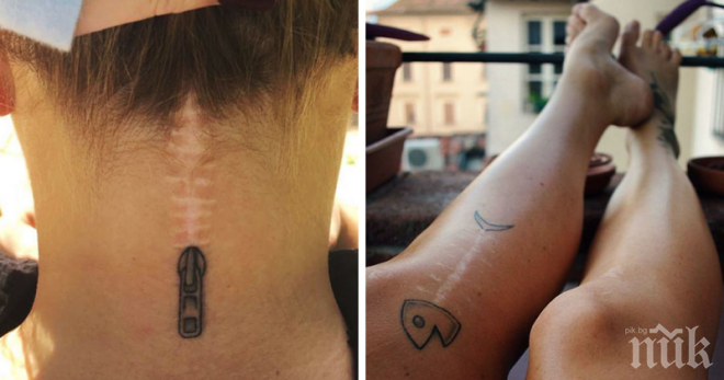 Татуировки, които превръщат грозните и отвратителни белези в произведения на изкуството
