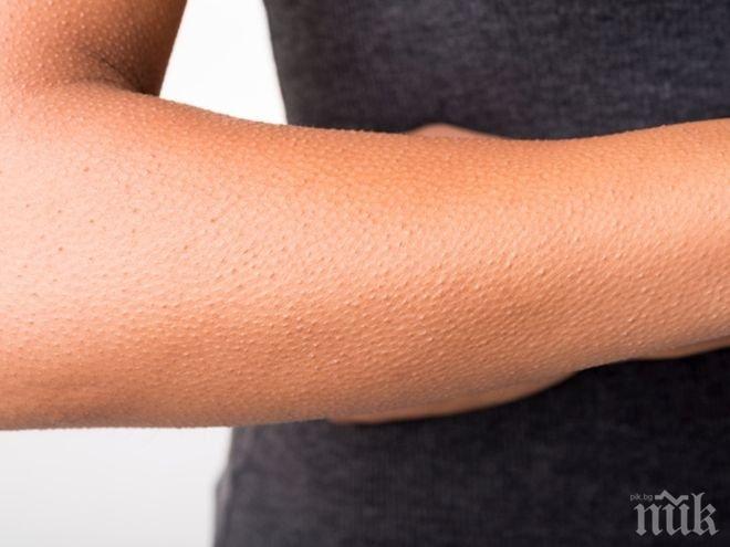 А ВИЕ ЗНАЕХТЕ ЛИ? Ето защо настръхваме