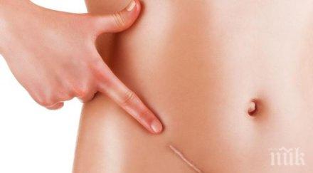 учени изобретиха ново лепило белези