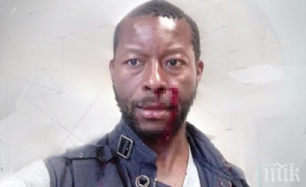 Ужас в центъра на София: Посред бял ден нападнаха и пребиха нигериец - финансист от Лондон