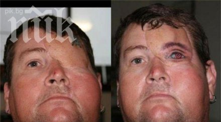 татуираха око ухапан паяк снимки