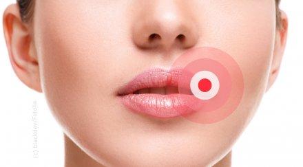 опасен щам напада братовчед шарката