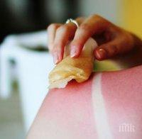 13 бързи трика при слънчево изгаряне