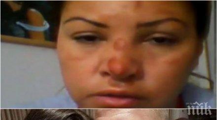 обезобразената сани алекса разкрития кошмара побоя имам зверски болки главата бившият приятел прибра паспорта