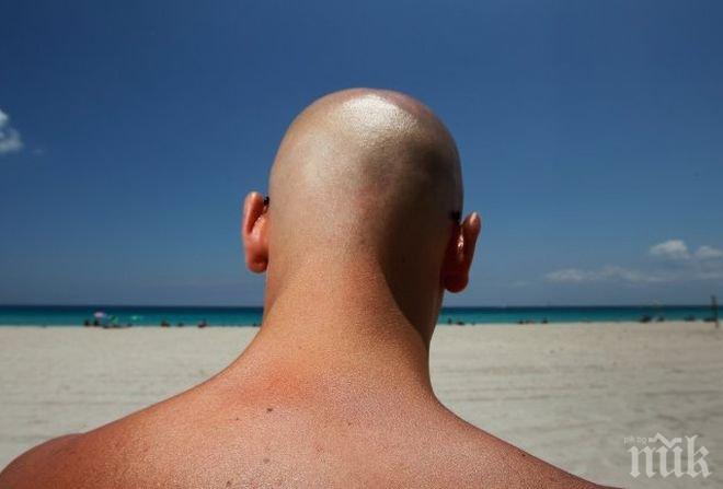 ВНИМАНИЕ! Мъжете с бръснати глави да си слагат слънцезащитен крем