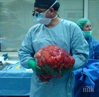 СЛЕД 5-ЧАСОВА ОПЕРАЦИЯ: Извадиха огромен тумор от корема на жена